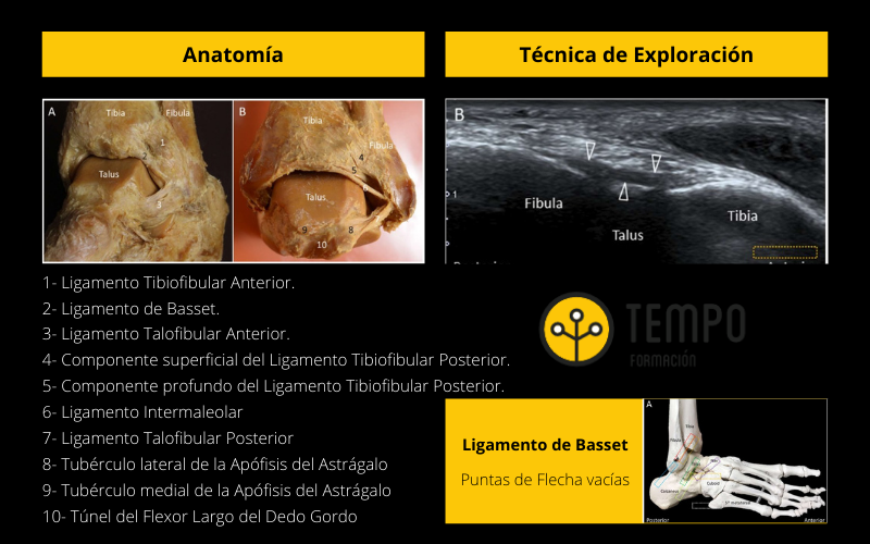 Ligamento Basset ecografía.png